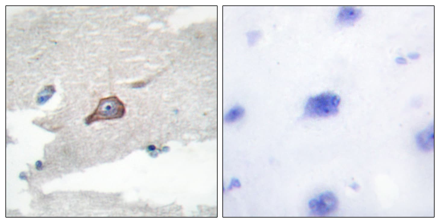 HCK Antibody (aa381-430)