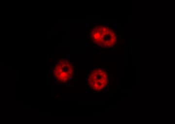 DDIT3 / CHOP Antibody (phospho-Ser30)