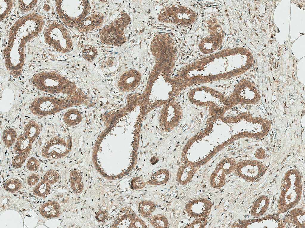 ER Alpha / Estrogen Receptor Antibody (Biotin)
