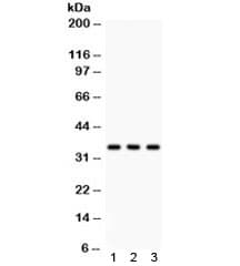 CASP7 / Caspase 7 Antibody