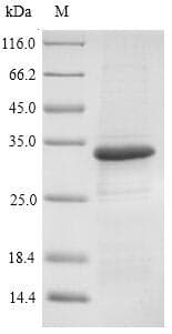 Rickettsia japonica omp Protein (Recombinant 6His-SUMO, N-terminus)