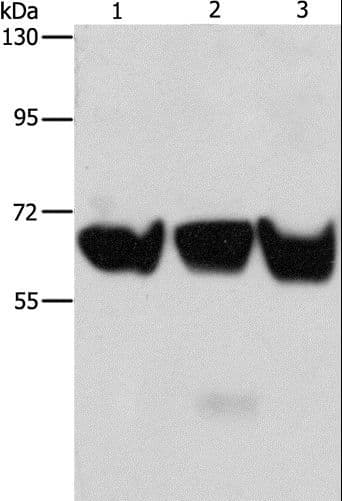 Polyclonal Rabbit anti-Human ADRA1B / Adrenoceptor alpha 1B Antibody (IHC, WB)