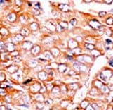 BID Antibody (phospho-Ser65)