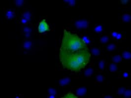RAB17 Antibody (clone OTI5E2)