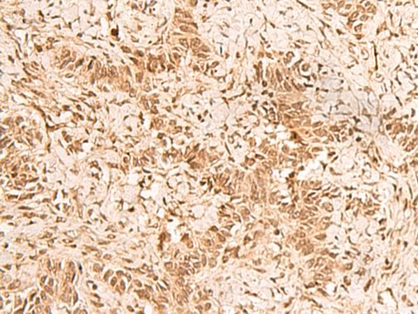 HOXC12 Antibody