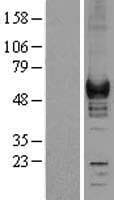 CORO1A / Coronin 1a Protein (Over-Expression Lysate Myc-DDK (Flag))