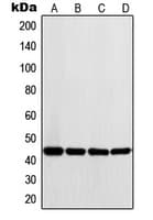 LYAR Antibody (Internal)