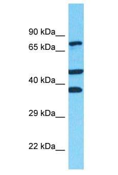 Polyclonal Rabbit anti-Human FANCD2 Antibody (aa351-400, WB)