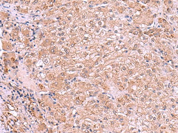 RIC3 Antibody