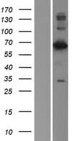 LMNB2 / Lamin B2 Protein (Over-Expression Lysate Myc-DDK (Flag))