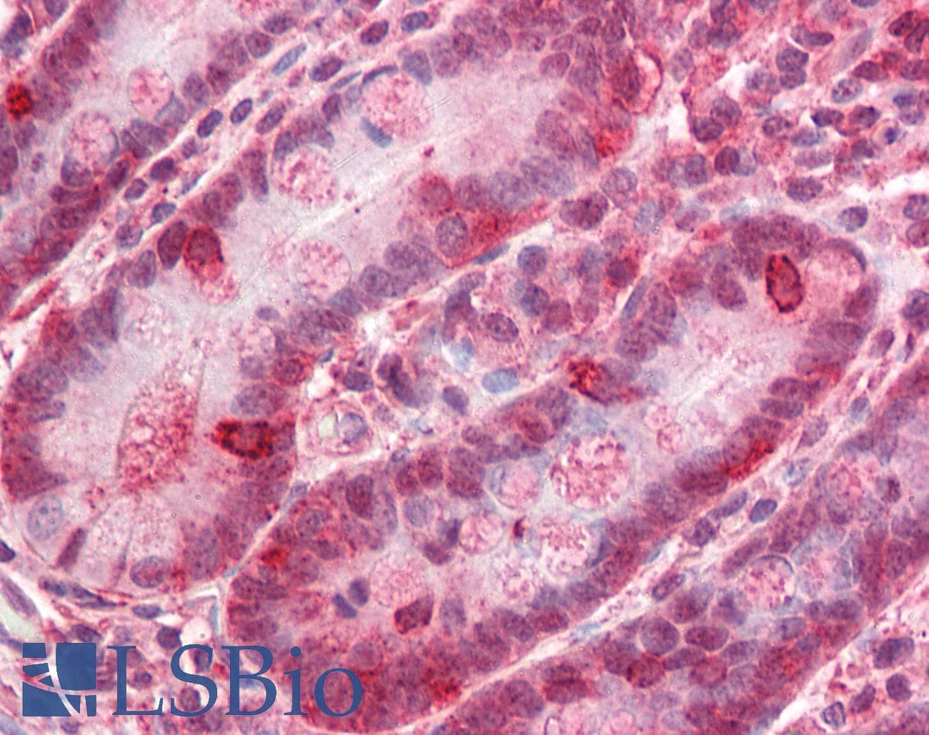 IHC-plus™ Polyclonal Rabbit anti-Human ZNF687 Antibody (IHC, IF, WB)