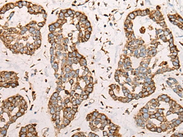 Polyclonal Rabbit anti-Human CAPN9 / Calpain 9 Antibody (IHC)