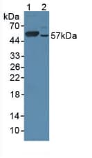 CYP17 / CYP17A1 Antibody (aa201-507, APC)
