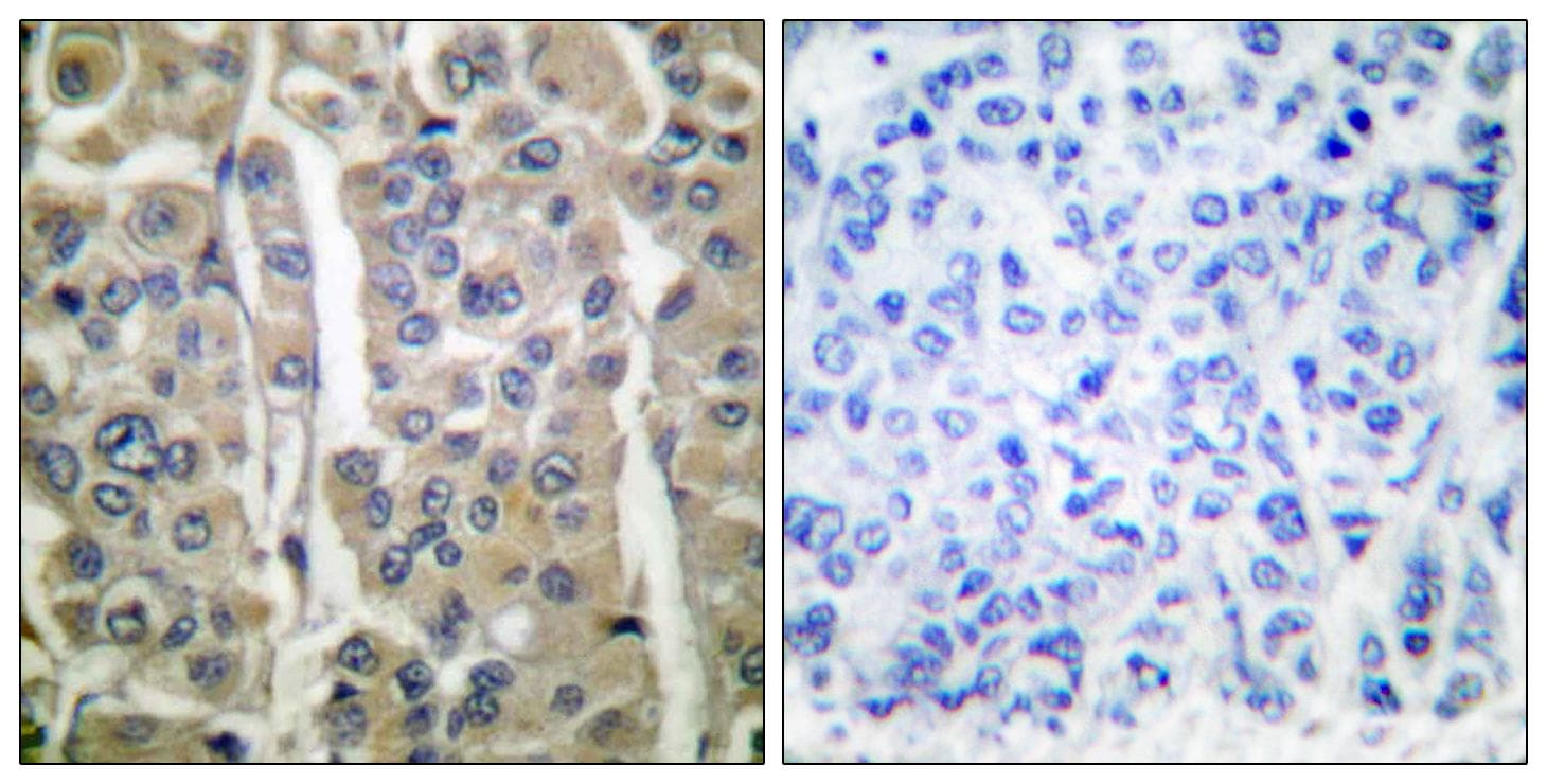 IVL / Involucrin Antibody