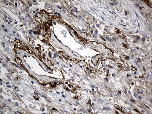 Monoclonal Mouse anti-Human MGP / Matrix Gla-Protein Antibody (clone OTI8D6, IHC, WB)