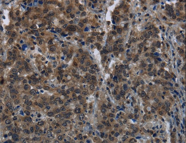 Polyclonal Rabbit anti-Human GALK1 / GK1 Antibody (IHC)