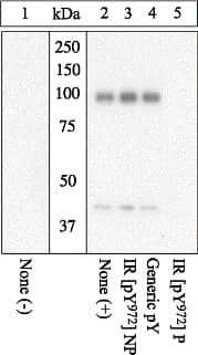 INSR / Insulin Receptor Antibody (phospho-Tyr972)
