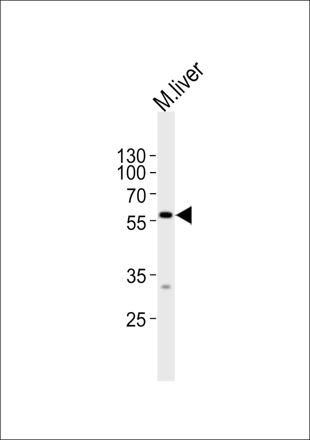 DPYS / Dihydropyrimidinase Antibody (aa470-501)