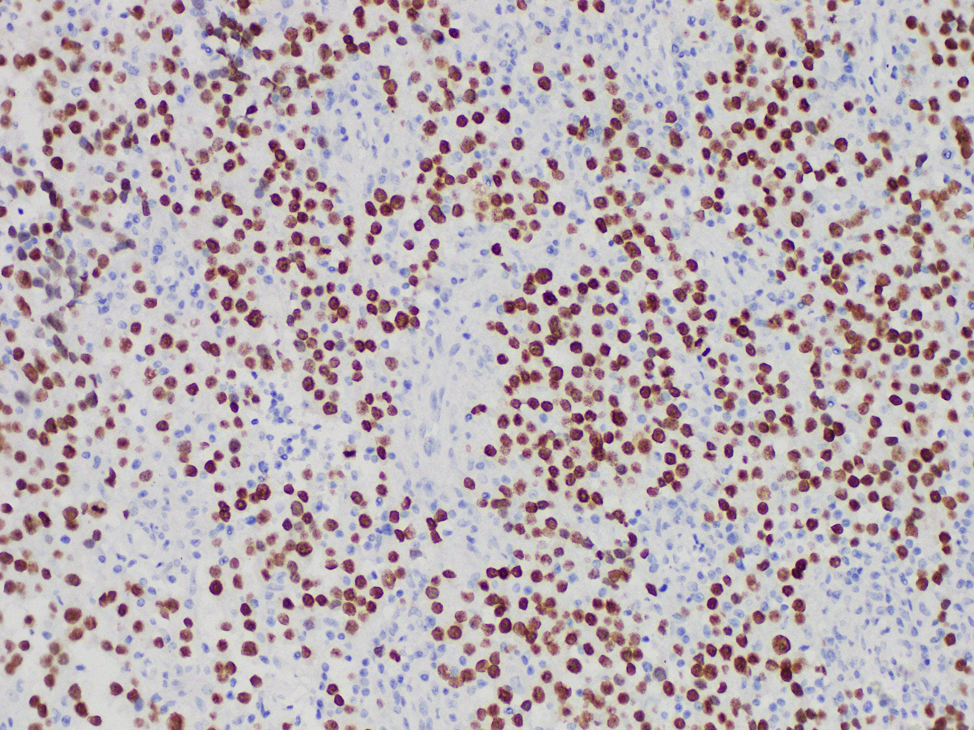 SALL4 Antibody