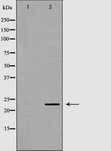 NEUROG3 / NGN3 / Neurogenin 3 Antibody