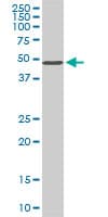 IHC-plus™ Monoclonal Mouse anti-Human STK38 Antibody (clone 6F1, IHC, WB)