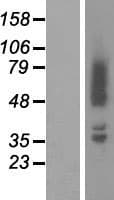ADD2 Protein (Over-Expression Lysate Myc-DDK (Flag))