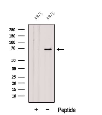 GPNMB / Osteoactivin Antibody