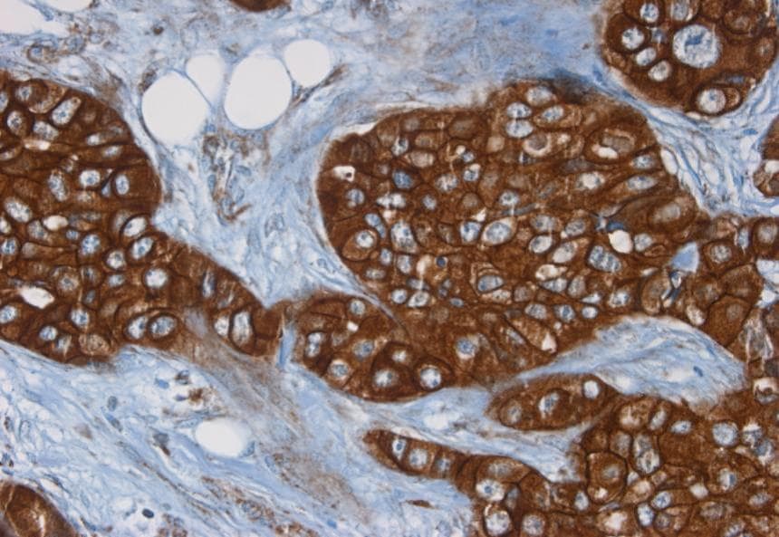 IHC-plus™ ERBB2 / HER2 Antibody (clone 3B5)