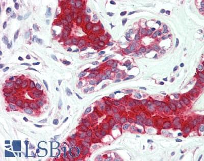 IHC-plus™ Polyclonal Rabbit anti-Human ATP6V1B1 Antibody (aa1-280, IHC, WB)