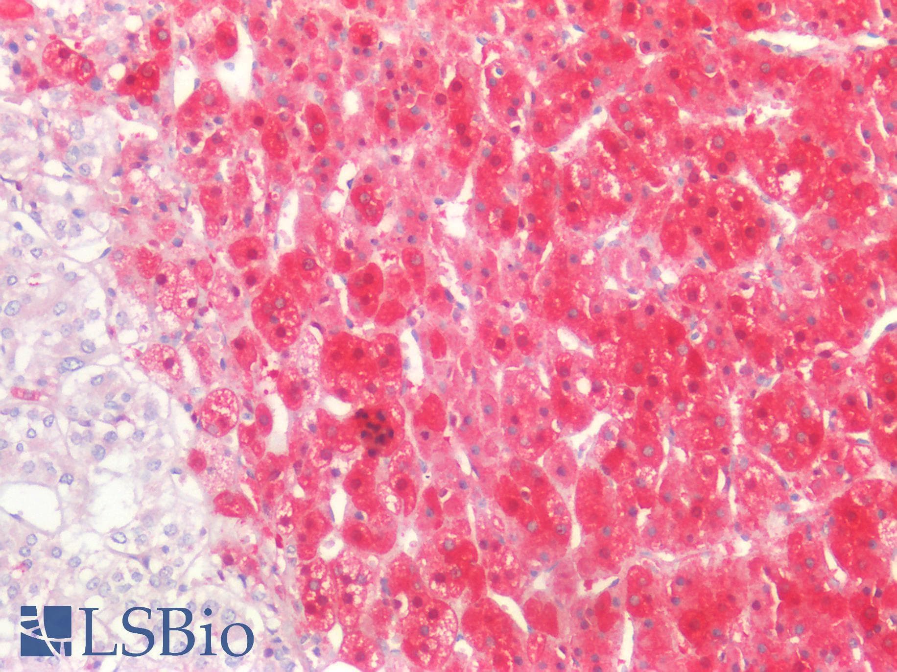IDH1 / IDH Antibody