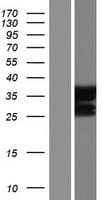 PRDM2 / RIZ1 Protein (Over-Expression Lysate Myc-DDK (Flag))