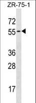 Polyclonal Rabbit anti-Human TCN1 Antibody (aa406-433, WB)