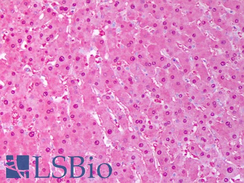 SOD1 / Cu-Zn SOD Antibody (FITC)