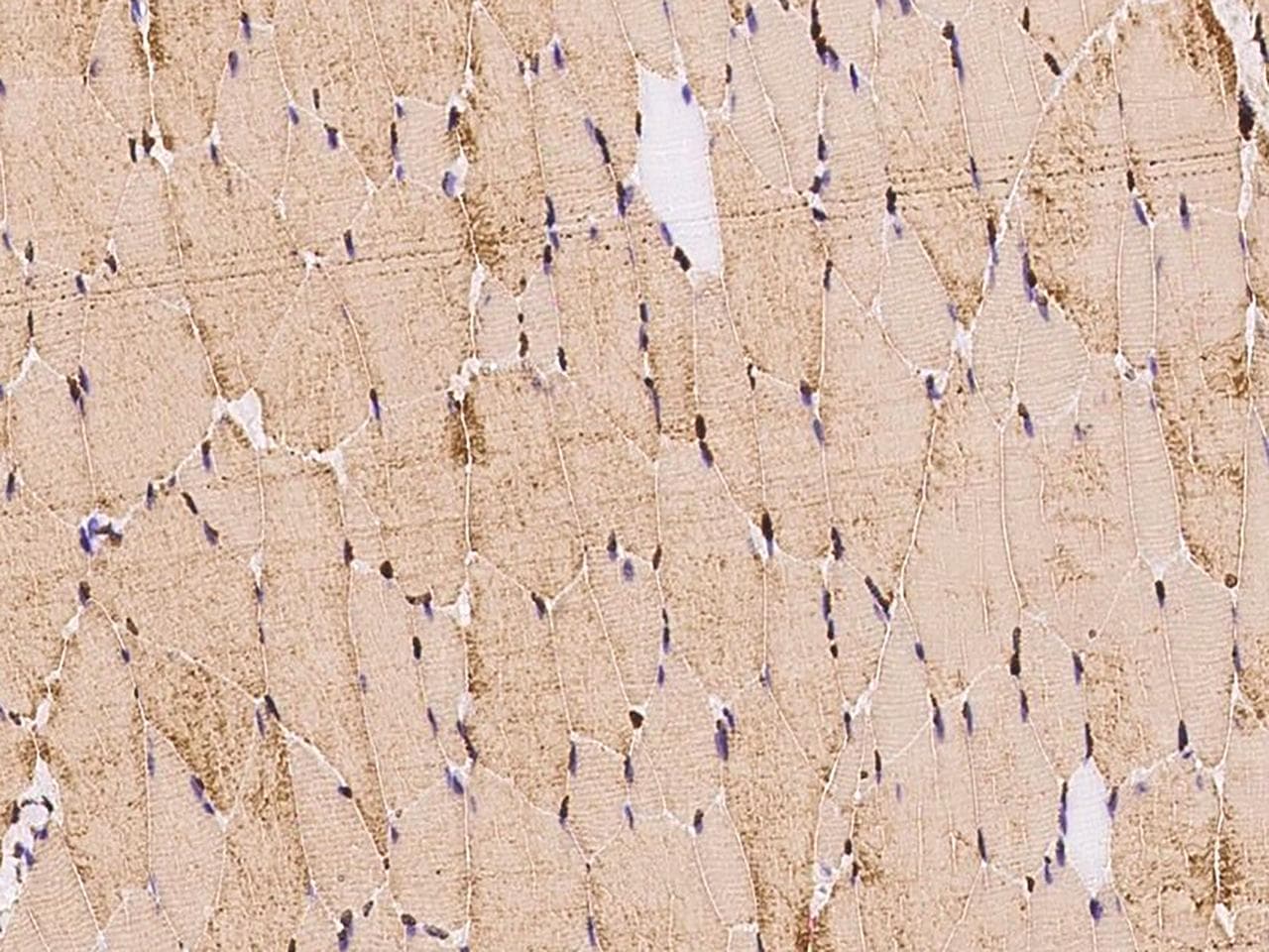 Polyclonal Rabbit anti-Human TNNI2 Antibody (Preservative Free, IHC, IF, WB)