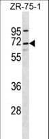 C10orf2 / PEO1 Antibody (aa656-684)