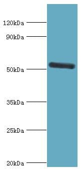 IRAK4 / IRAK-4 Antibody (aa1-220)