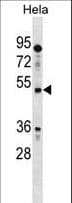IL13RA1 / IL13R Alpha 1 Antibody (aa56-85)