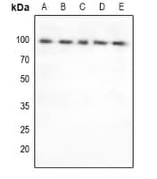 FOXO3 / FOXO3A Antibody