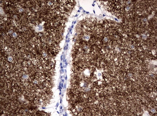 Monoclonal Mouse anti-Human SYP / Synaptophysin Antibody (clone UMAB112, Carrier-free, IHC, IF, WB)
