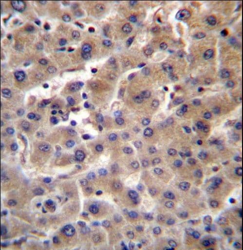 Polyclonal Rabbit anti-Human GUSB / Beta Glucuronidase Antibody (aa515-544, IHC, WB)