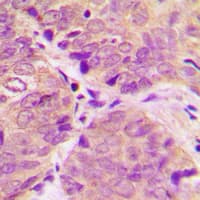 PPP1R1B / DARPP-32 Antibody (phospho-Thr34)