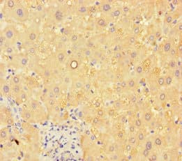 ANGPTL8 / Betatrophin Antibody