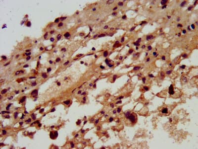 RAMA1 / SKA3 Antibody
