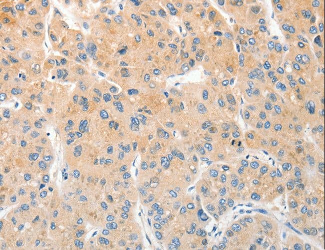 Polyclonal Rabbit anti-Human RPN1 / Ribophorin I Antibody (IHC, WB)