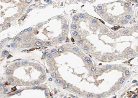 PLIN3 / M6PRBP1 / TIP47 Antibody