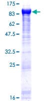 Human GARS / Glycyl tRNA Synthetase Protein (Recombinant GST)