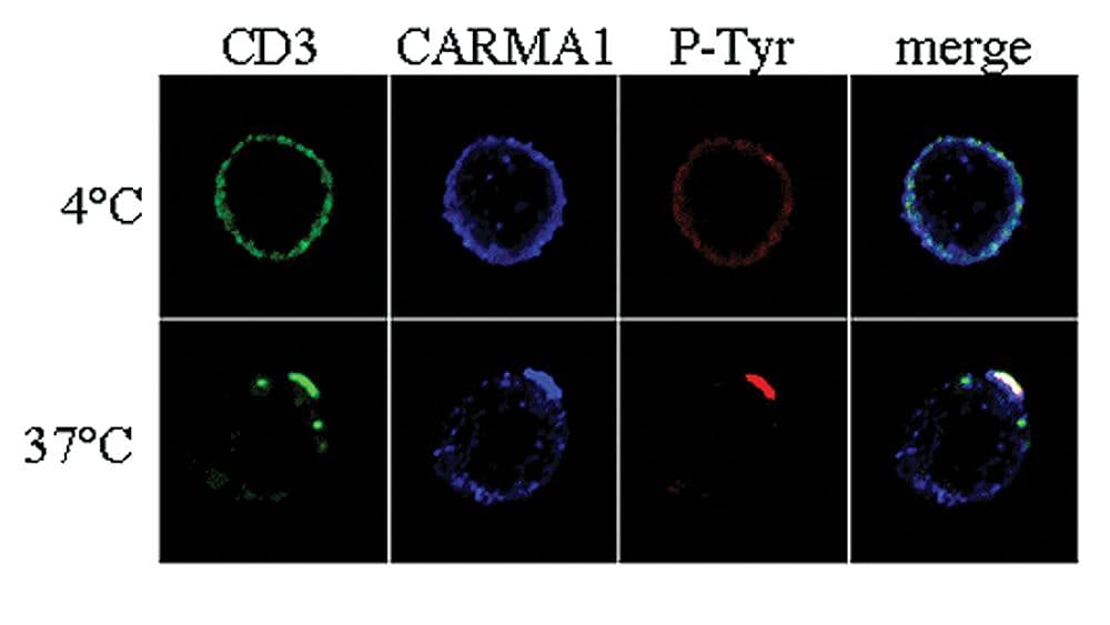 CARMA1 / CARD11 Antibody (aa1-221)