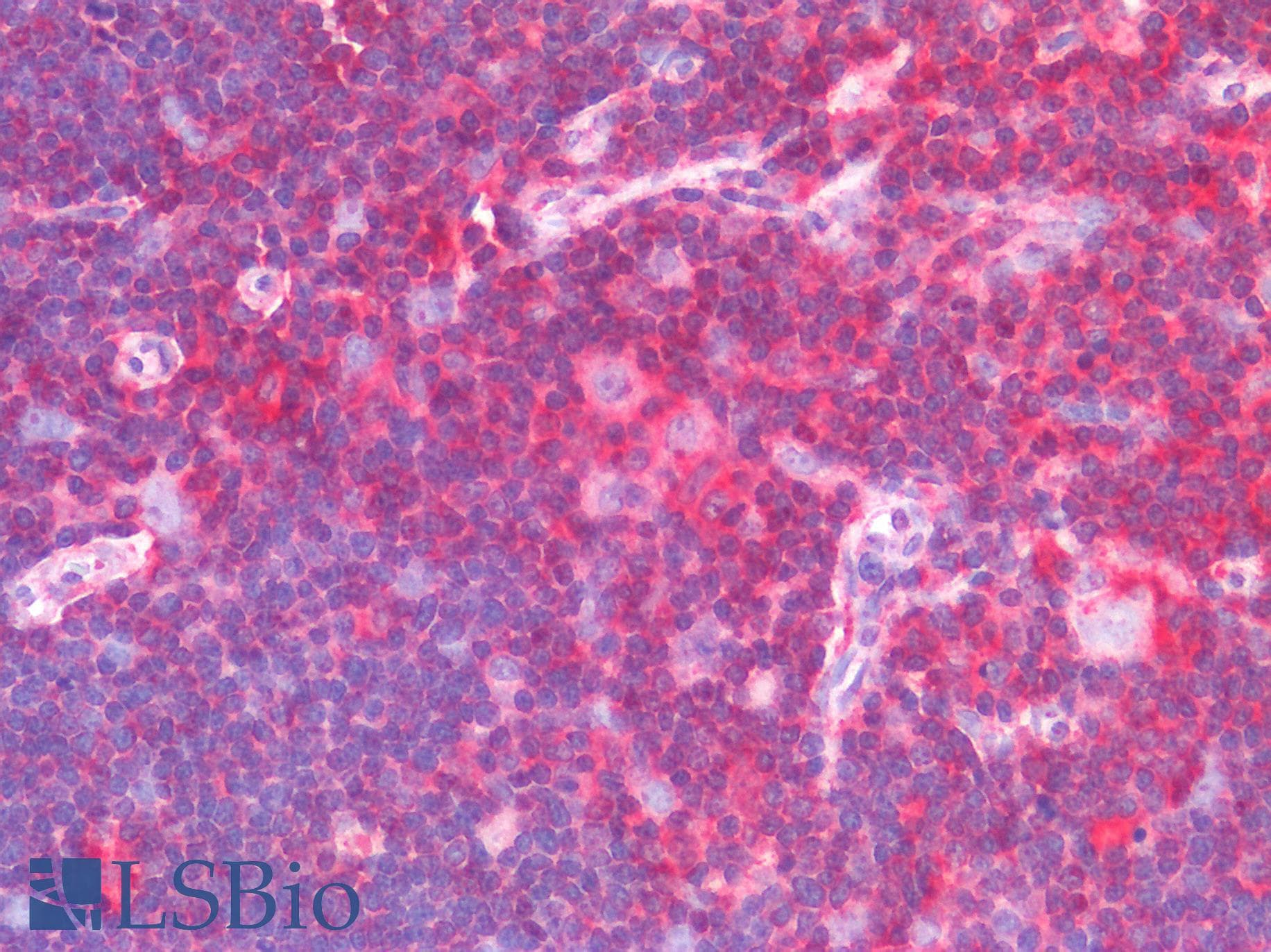 PathPlus™ Monoclonal Mouse anti-Human HCLS1 Antibody (clone 2A8, IHC, WB)