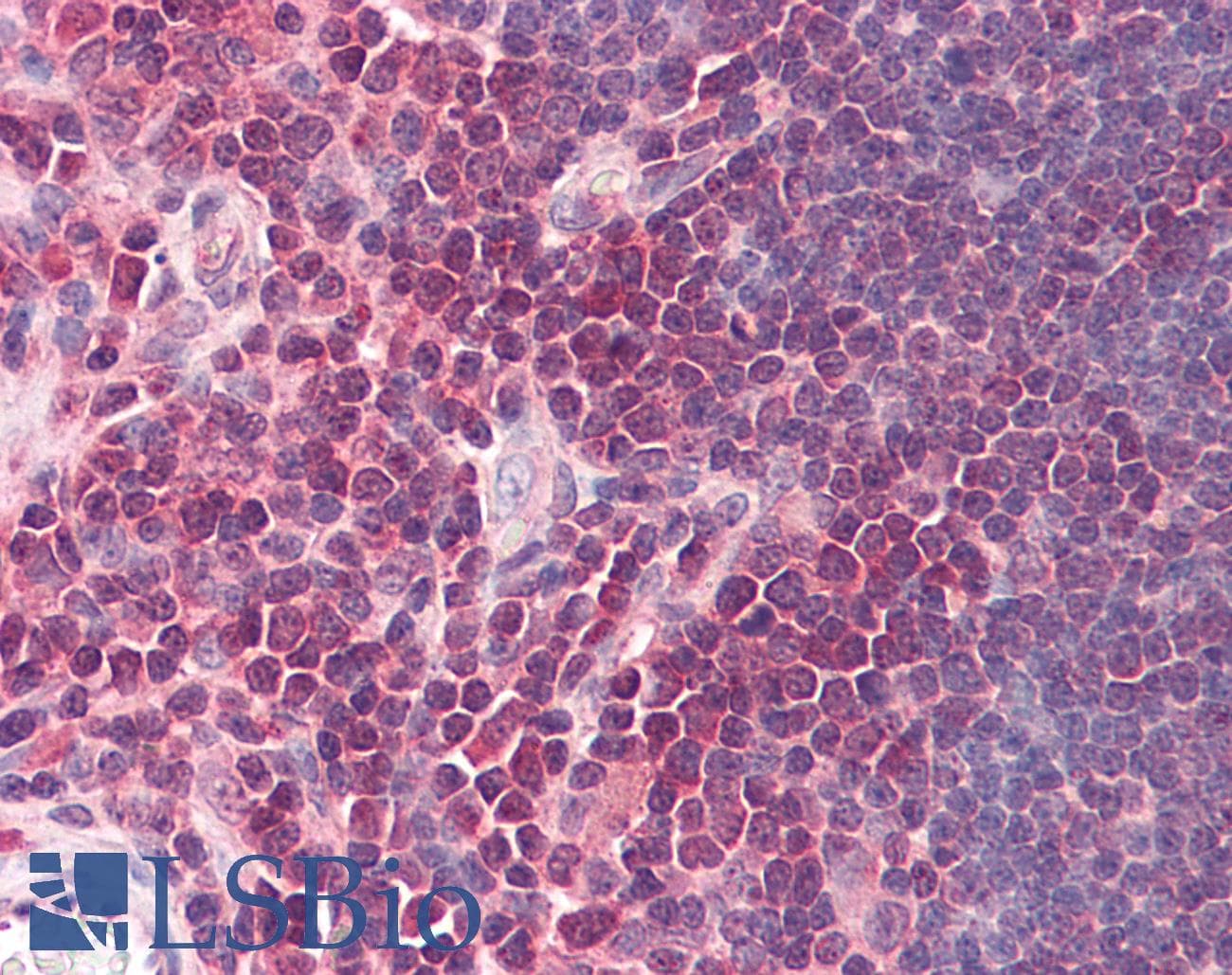 IHC-plus™ TRADD Antibody