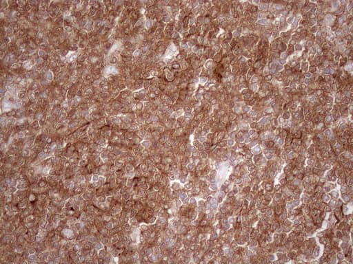 POU2AF1 / BOB1 Antibody (clone OTI3A5)